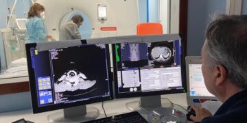 LA SVOLTA. L’intelligenza artificiale aiuta i medici a valutare se operare il tumore al pancreas: presentato il percorso sperimentale del Cardarelli e del Dipartimento di Informatica della Federico II